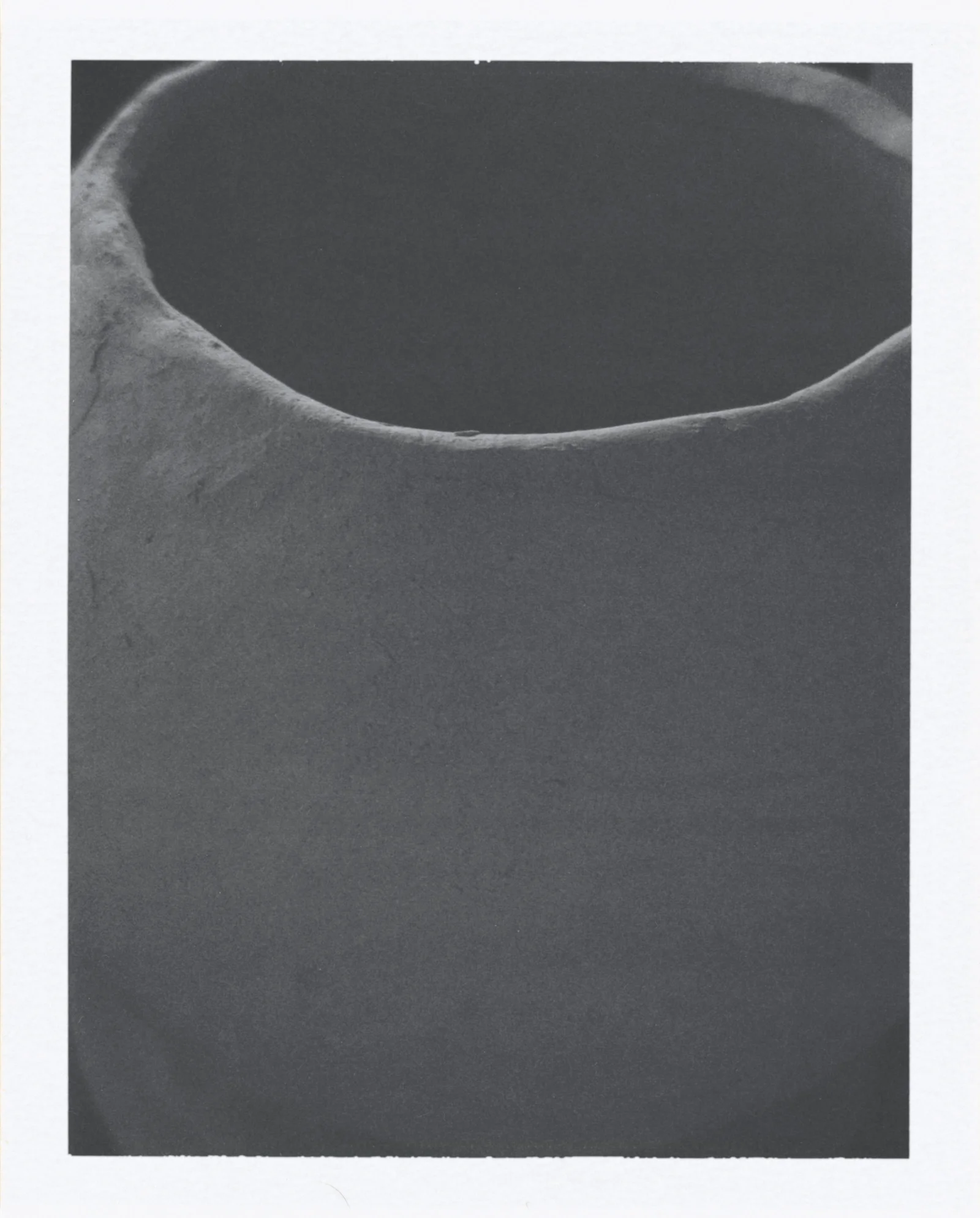 The egg vessel